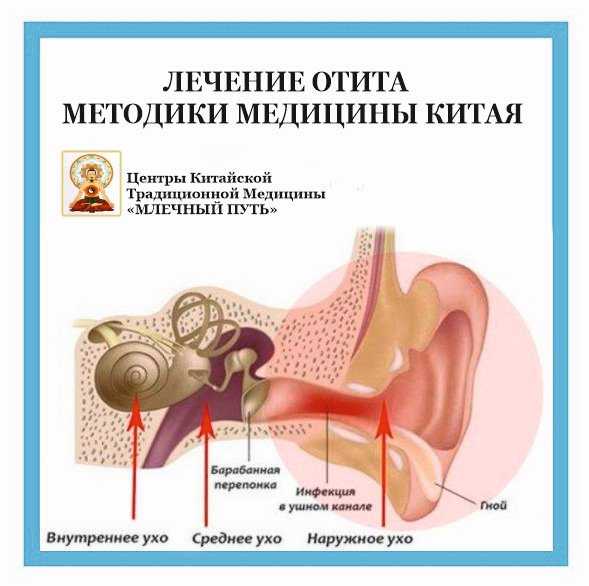 Воспаление уха чем лечить в домашних условиях